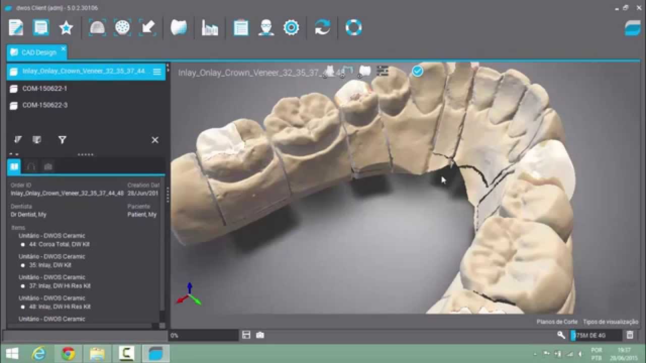 dental smile design software download